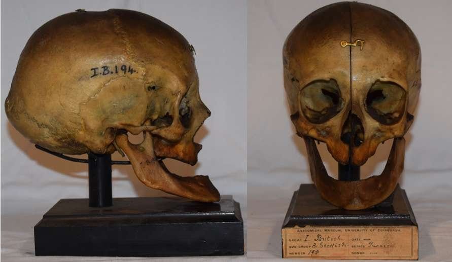 HABERİM 724 | 2000 yaşında! Ona ‘Druid’ diyolar…