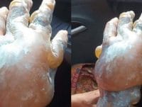 HABERİM 724 | Kas hastası İsveçli çocuk Türk vatandaşlığına geçti