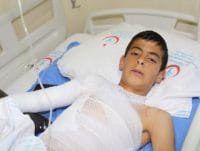 HABERİM 724 | Videotorakoskopi nedir