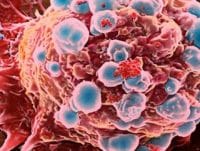 HABERİM 724 | 200'den fazla hastalık besin yoluyla yayılıyor