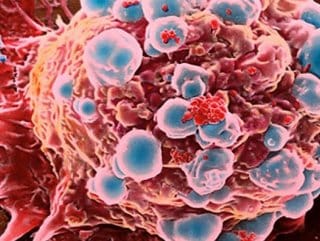 haftada-bir-sise-sarap-10-sigara-kadar-ziyanli-WNdf4vEM.jpg HABERİM 724 | Haftada bir şişe şarap, 10 sigara kadar ziyanlı