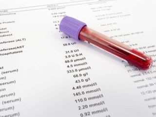 hemogram-nedir-uPgZeZbp.jpg HABERİM 724 | Hemogram nedir