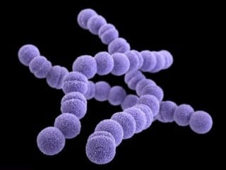 ingilterede-12-kisi-bakteri-yuzunden-hayatini-kaybetti-ai9WNjEO.jpg HABERİM 724 | İngiltere'de 12 kişi bakteri yüzünden hayatını kaybetti