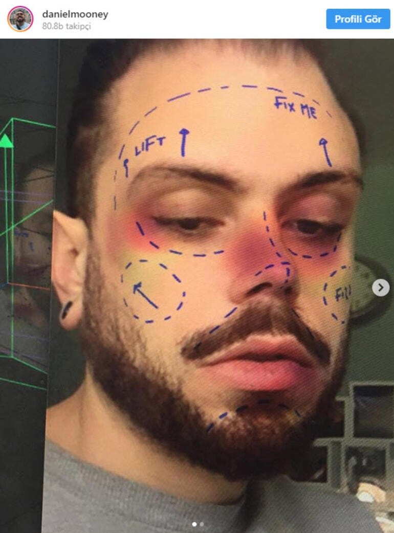 HABERİM 724 | Instagram “estetik operasyon filtrelerini” kaldırıyor! İşte gerekçesi…