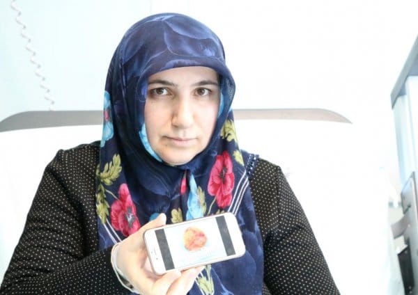 HABERİM 724 | Şanssız bayanın kalbinden kitle çıkarıldı