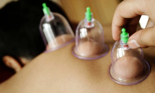 HABERİM 724 | Tabipler Birliği hacamata karşı