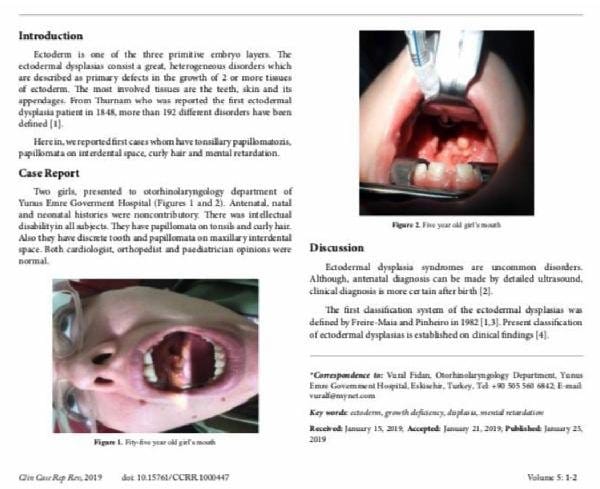 HABERİM 724 | Türk hekimin buluşu dünya tıp literatürüne girdi