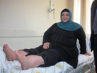 HABERİM 724 | Zayıflamak isterken hayatından oluyordu